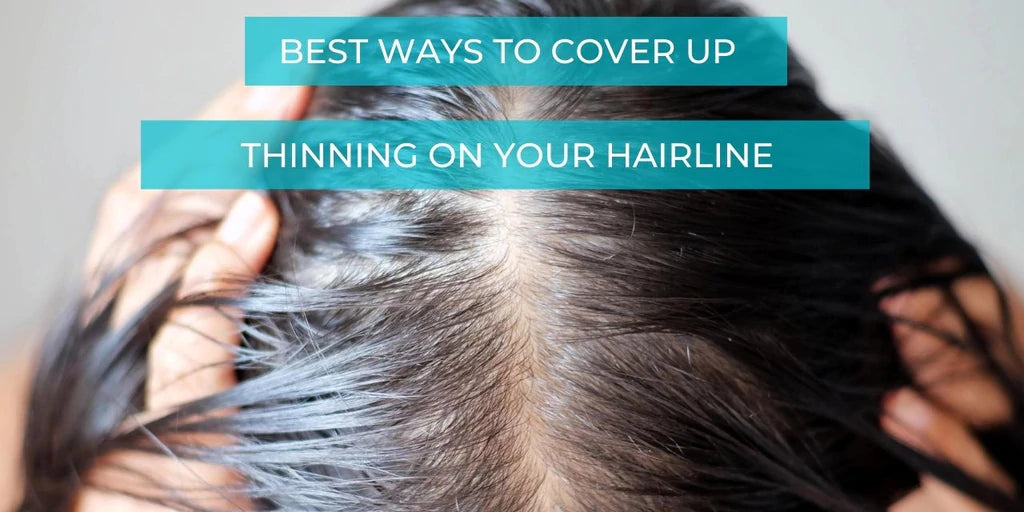 Best Ways To Cover Up Thinning On Your Hairline