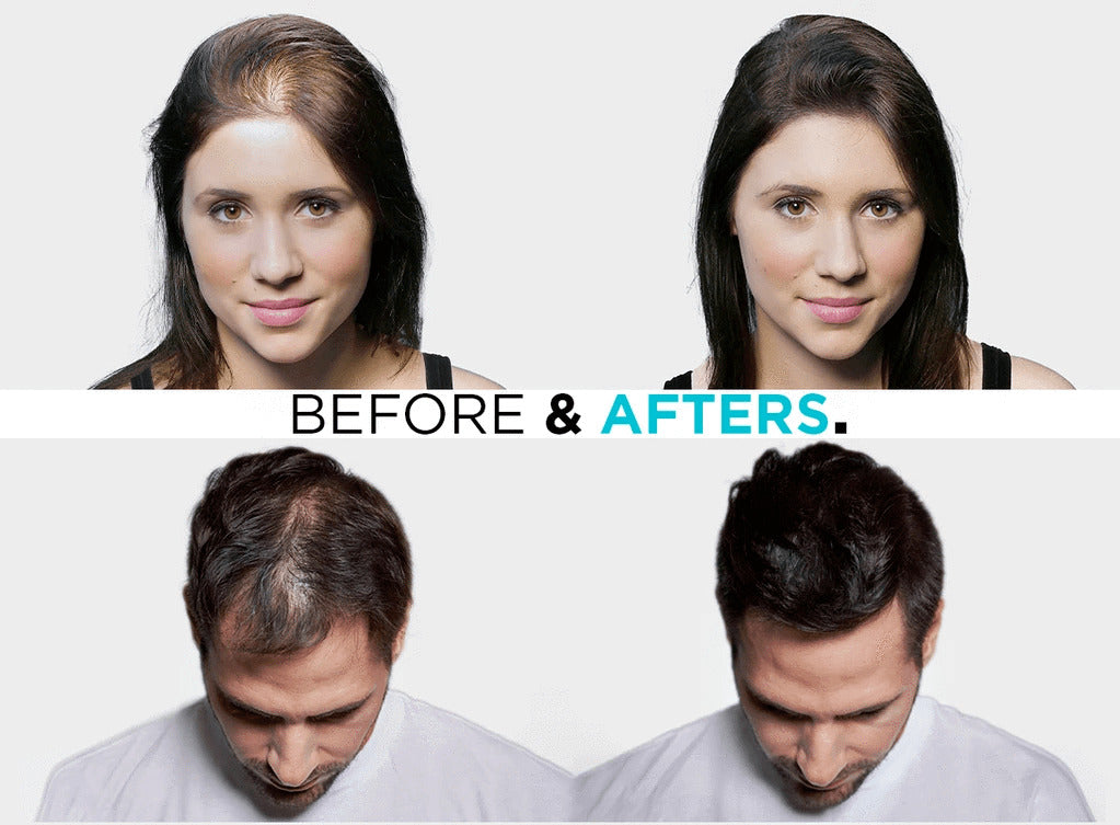 SureThik Hair Fibers India | Nutra Skyn Care